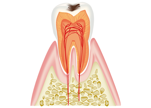 C1